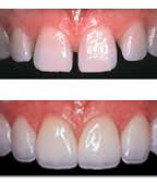 سلامت و زیبایی دنداهان های شما در کلینیک 57 دکتر شکیبا