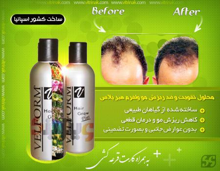 محلول تقویت کننده و ضد ریزش موی سر ولفرم هیر