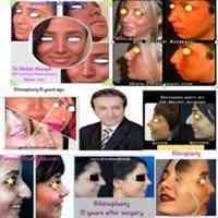 جراح بینی خوب  dr mehdi ahmadi