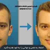 ترمیم مو اندیشه