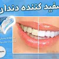 سفید کننده دندان وایت لایت