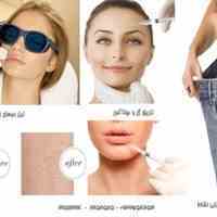 لیزر جهت حذف دایمی موی زاید بدن در مرکز پزشکی زیبایی نشاط
