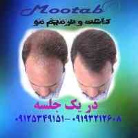 کاشت وترمیم موی موتاب 