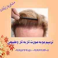 کاشت وترمیم موی موتاب (موهای طبیعی)