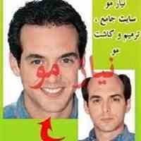 فروش لوازم ترمیم مو