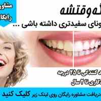 بسته سفید کننده دندان
