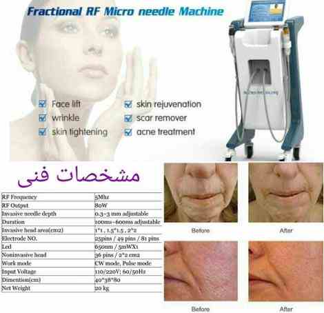 RF فرکشنال 