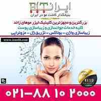 لیزر موهای زائد