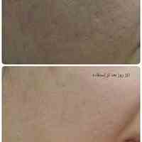 پکیج کرم های زیبایی ویژه عید غدیر