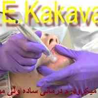 لیزر بوتاکس زیبایی مزوتراپی ونک 