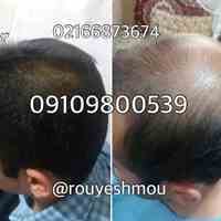 رویش مجدد موهای از دست رفته 