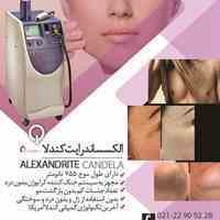 اجاره دستگاه الکساندرایت کندلا