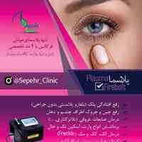 پلاسما : Plasma FIREBOLT