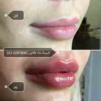 کلینیک تخصصی تزریق ژل و بوتاکس ماه طلایی