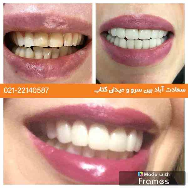 خدمات دندانپزشکی با بهترین دندانپزشک تهران