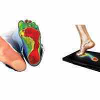 اسکن کف پا | درمان درد کف پا | درمان درد زانو | درمان آرتروز زانو