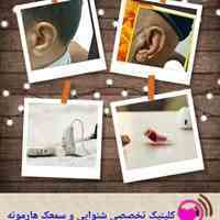 سمعک هارمونه