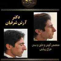 جراحی بینی با بروزترین متد روز دنیا
