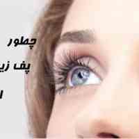 برداشتن پف چشم در نیم ساعت
