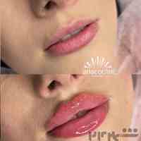 بوتاکس، زاویه سازی، لیزر مو الکساندرایت، مزوتراپی، میکرونیدلینگ ، برداشت پلک، برداشت غبغب