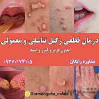 درمان قطعی زگیل تناسلی