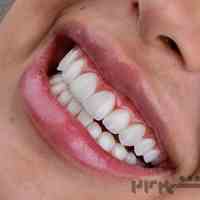 انواع خدمات دندانسازی