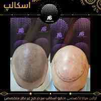 اسکالپ میکرو اسکالپ اسکالپ سر اسکالپ در کرج