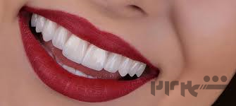 طرح تخفیفی خدمات زیبایی دندانپزشکی 
