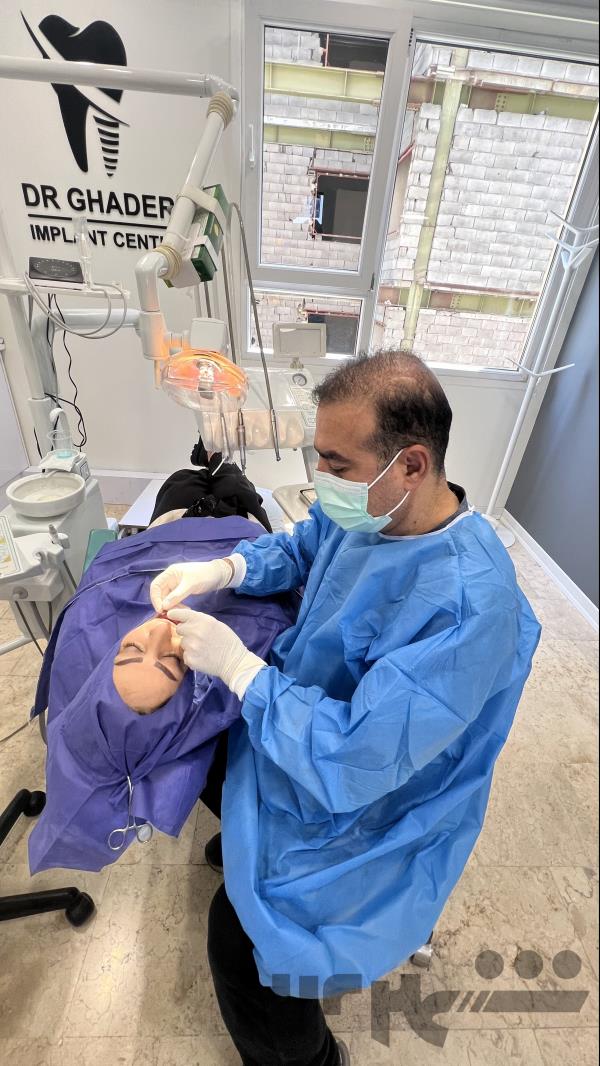 خدمات دندانپزشکی. ایمپلنت جراحی لثه دکتر قادری