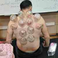 آموزش حجامت 