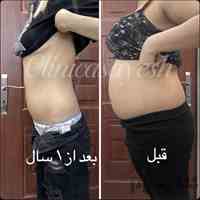  لاغری در صادقیه