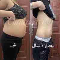 لاغری فوری در طول دو ماه