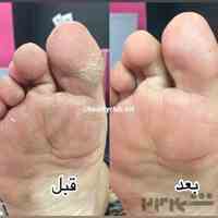 پدیکور اصفهان 093002002868