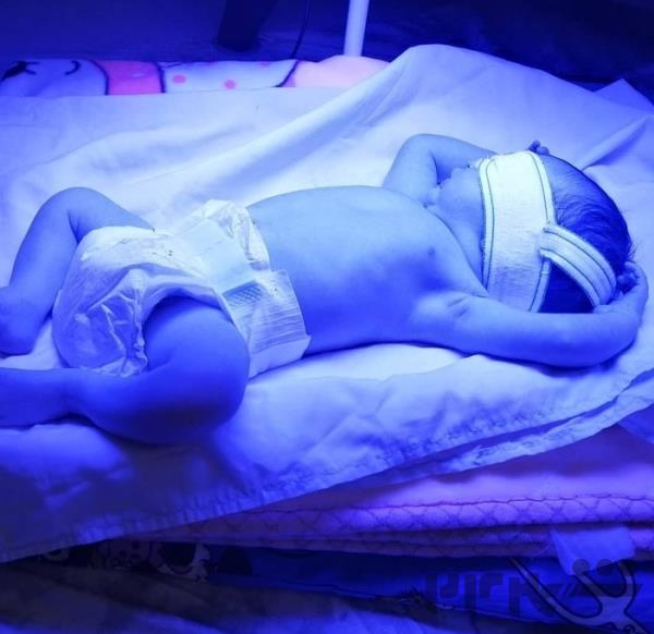 اجاره دستگاه رفع زردی نوزاد فتوتراپی در سنندج