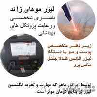 لیزر موهای زائد بدن