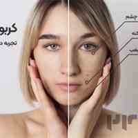 لیزر موهای زائد مطهری گرگان