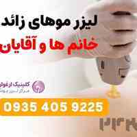 قیمت لیزر موهای زائد بدن(خانم ها و آقایان) | کلینیک لیزر ارغوان