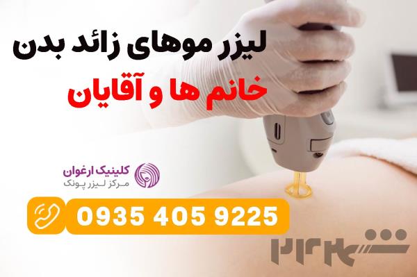 قیمت لیزر موهای زائد بدن(خانم ها و آقایان) | کلینیک لیزر ارغوان