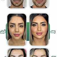 تخفیف باورنکردنی تزریق فیلر لیبل دار موندگاری بالا