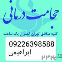 حجامت تخصصی در محل و بادکش کل تهران 