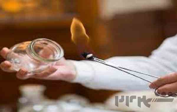  اموزش دوره‌های تخصصی حجامت، زالو درمانی و بادکش
