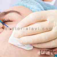 برداشتن خال و ضایعات پوستی