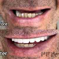 ایمپلنت دندان با شرایط پرداخت اقساطی