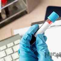 آزمایشگاه دکتر علیزاده در شهریار