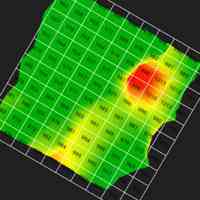 اسکنر کونراد تصویری 3D