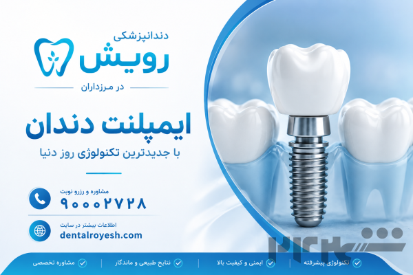 ایمپلنت دندان در تهران 