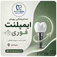 ایمپلنت فوری | دندانپزشکی رویش