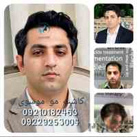 کاشت مو