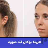 خدمات بوکال فت صورت در کلینیک زیبایی کیمیا اکسیر