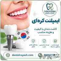 ایمپلنت کره ای ارزان 